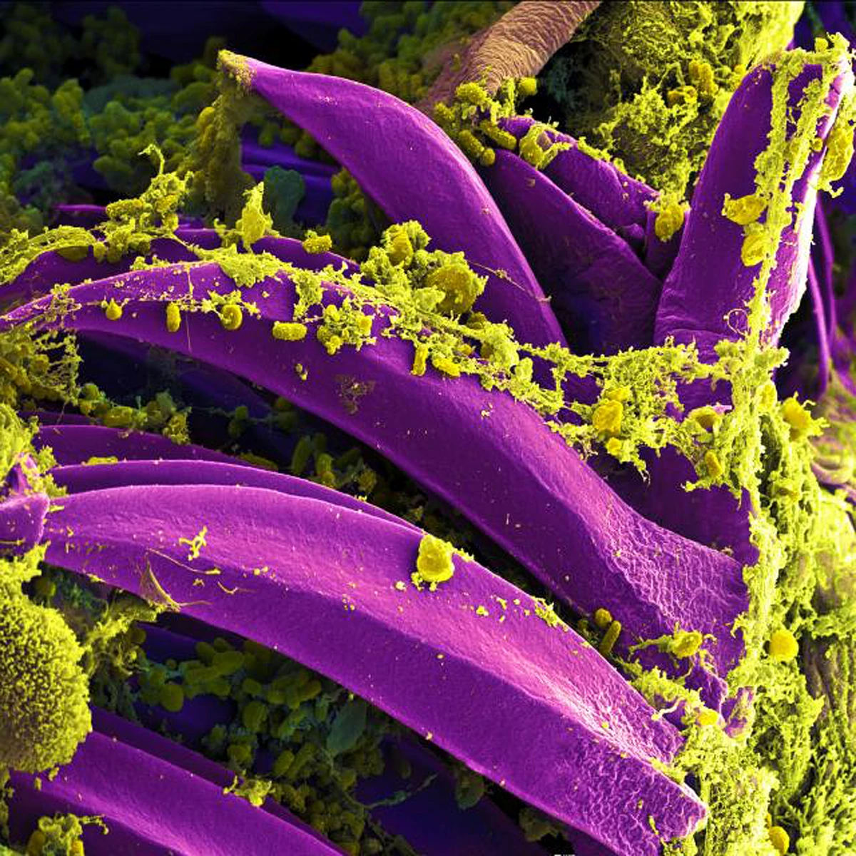 Żółte skupiska bakterii Yersinia pestis na fioletowych kolcach wyściełających przedżołądek pchły
