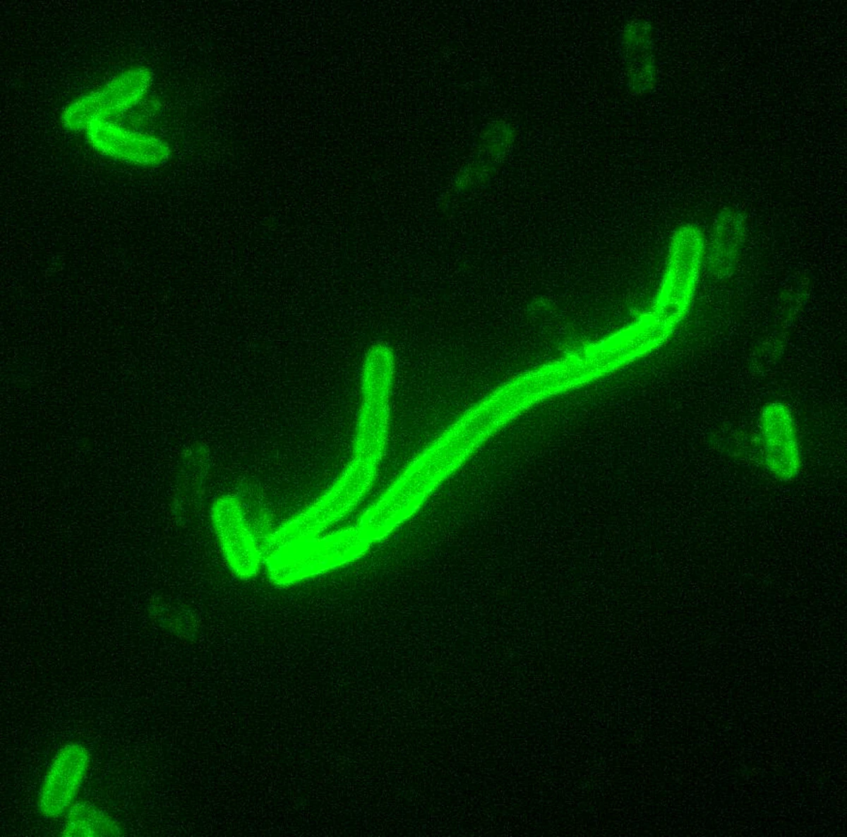 Zielono fluorescencyjne pałeczki Yersinia pestis widoczne na ciemnym tle w obrazie mikroskopowym
