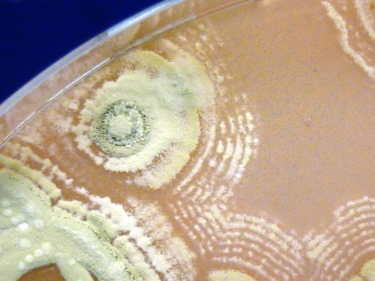 Kolonie Streptomyces sp. myrophorea rosnące na pożywce agarowej